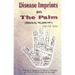 Disease Imprints on The Palm: Medical Palmistry: A Treatise on Diagnosis of Diseases through the study of Various Signs on the Hand [Paperback] O. P. Verma